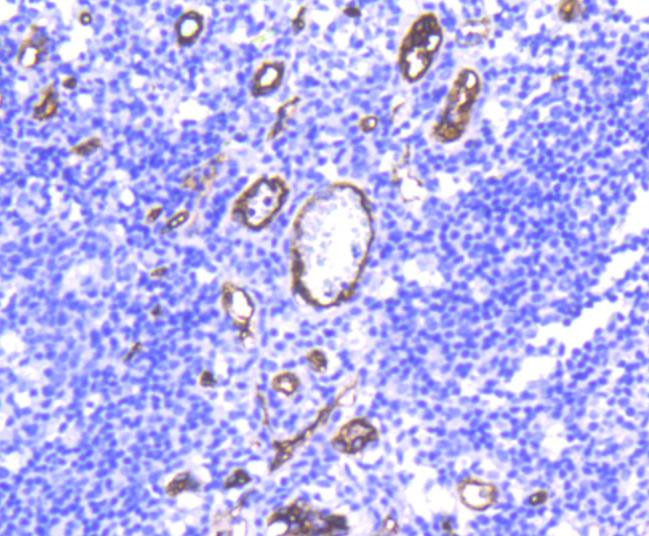 CD34 Antibody in Immunohistochemistry (Paraffin) (IHC (P))