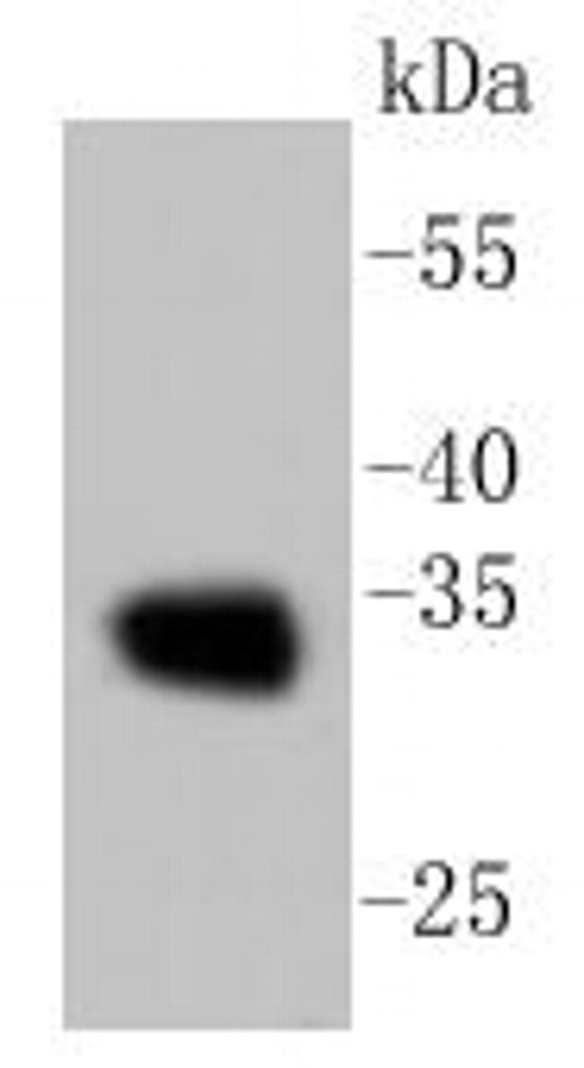 Calponin 1 Antibody in Western Blot (WB)