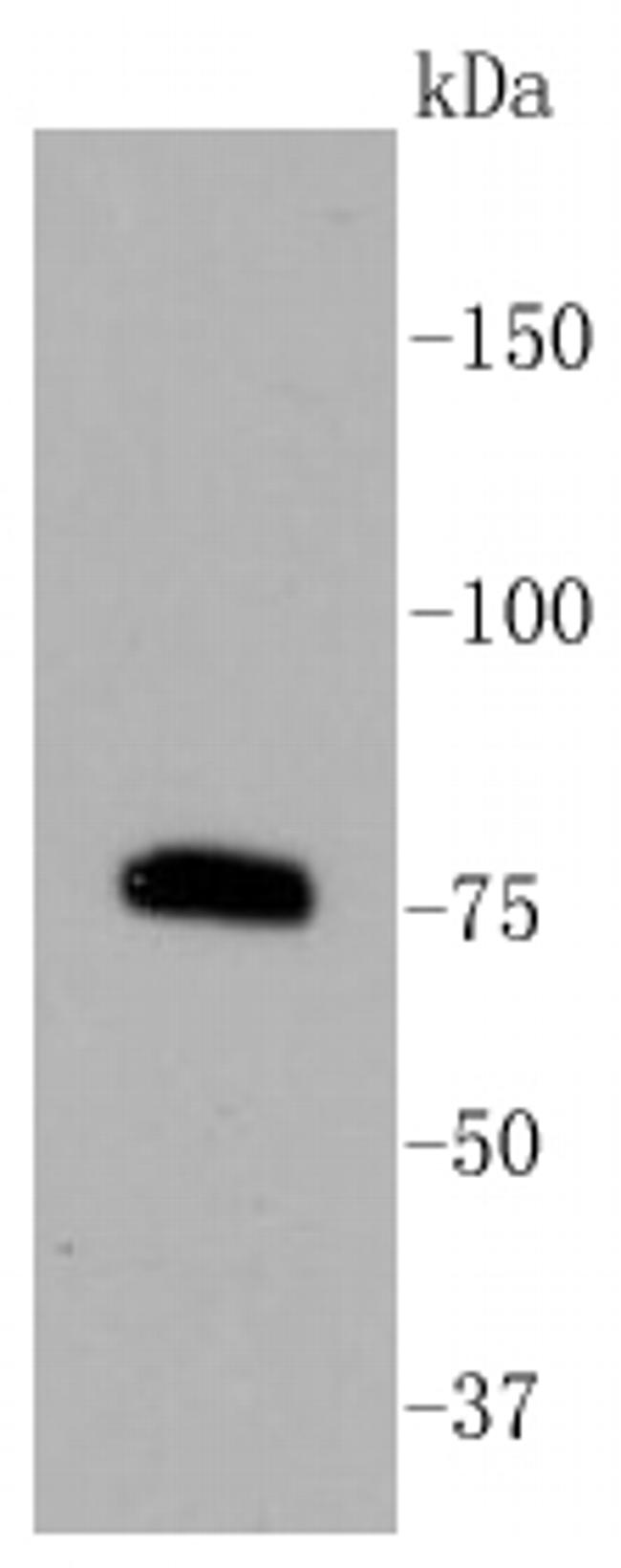 PKC beta-2 Antibody in Western Blot (WB)