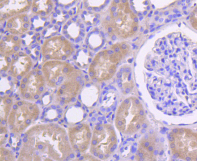 Collagen I Antibody in Immunohistochemistry (Paraffin) (IHC (P))