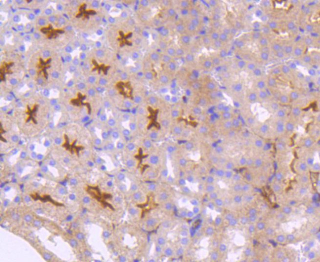 CD304 (Neuropilin-1) Antibody in Immunohistochemistry (Paraffin) (IHC (P))
