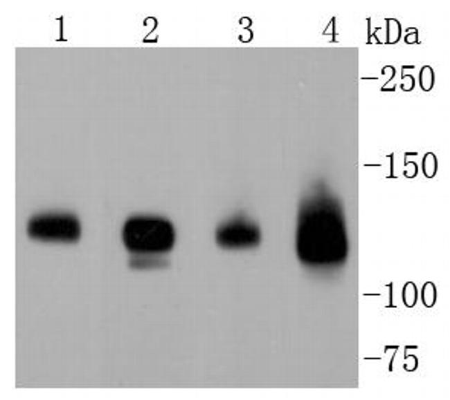 CD304 (Neuropilin-1) Antibody in Western Blot (WB)