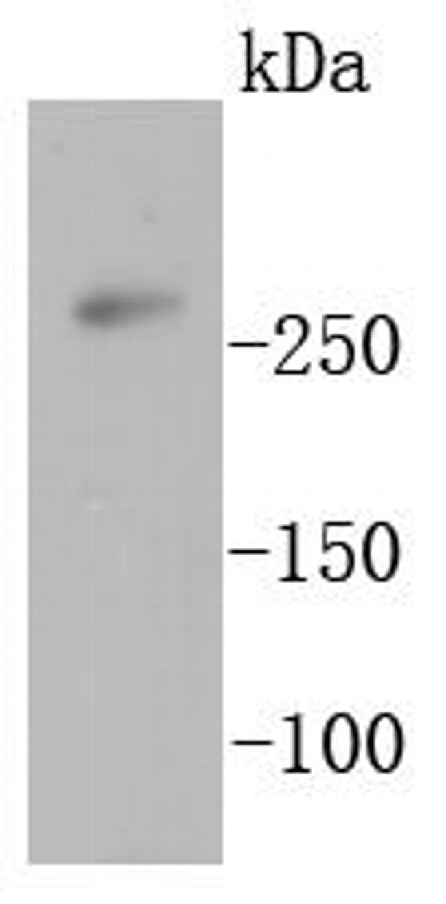 Acetyl-CoA Carboxylase Antibody in Western Blot (WB)