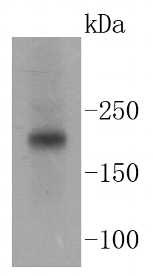TSC2 Antibody in Western Blot (WB)