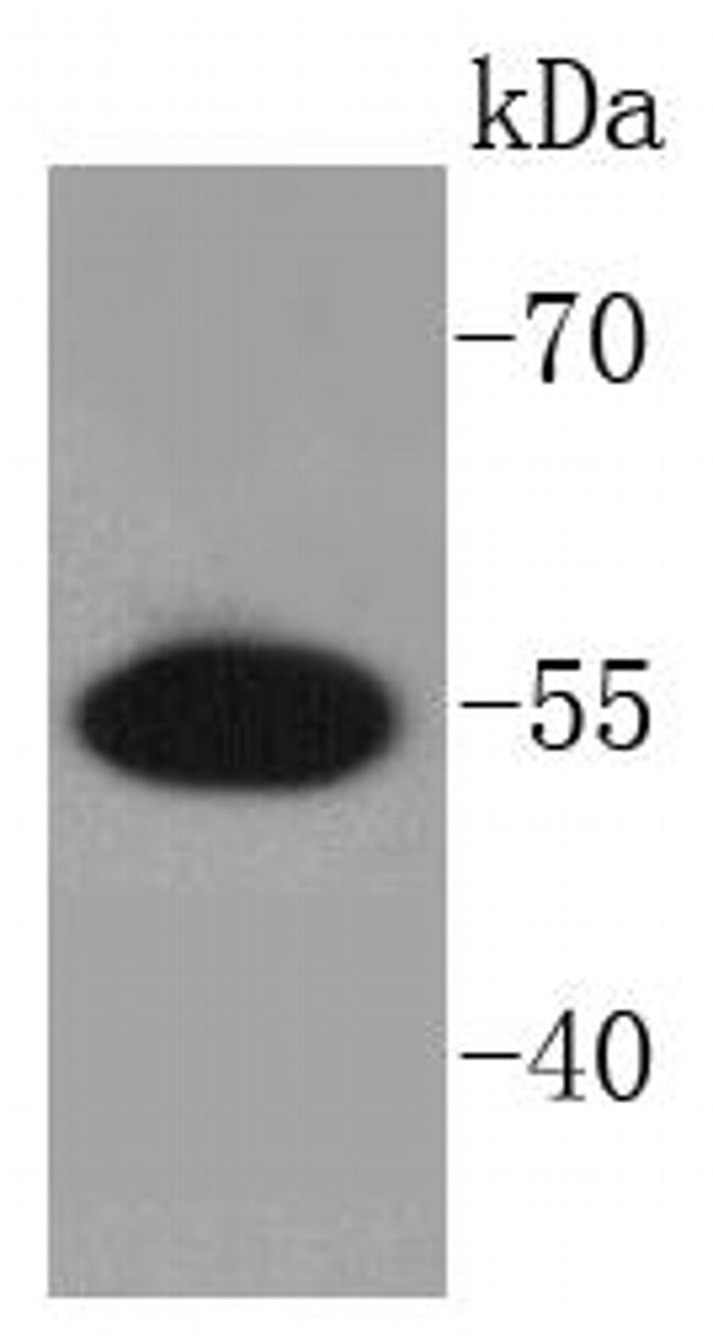 PRP19 Antibody in Western Blot (WB)