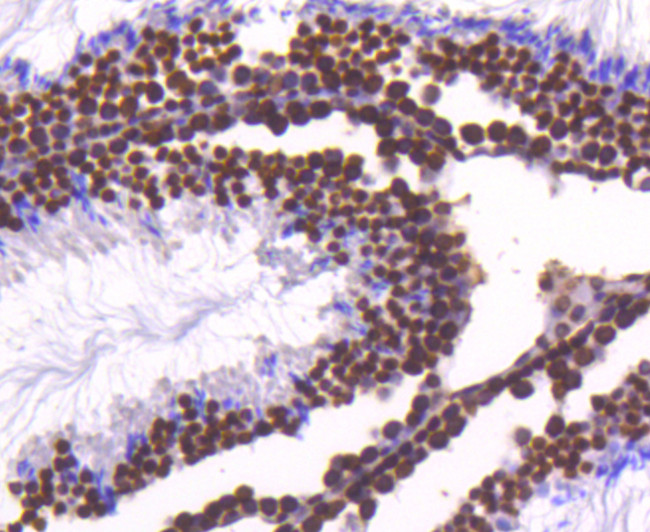 Histone H4 Antibody in Immunohistochemistry (Paraffin) (IHC (P))