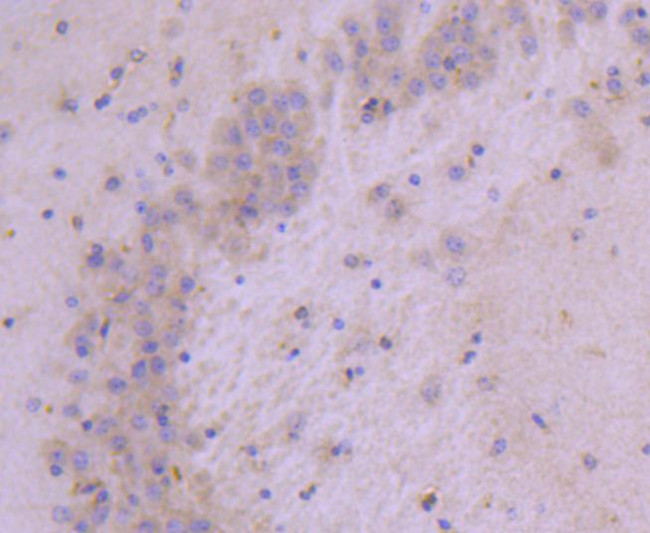 HSPB8 Antibody in Immunohistochemistry (Paraffin) (IHC (P))