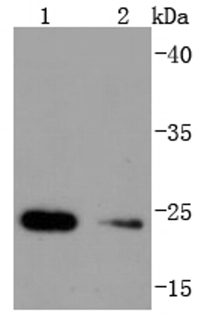 HSPB8 Antibody in Western Blot (WB)