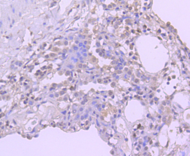 BMI-1 Antibody in Immunohistochemistry (Paraffin) (IHC (P))