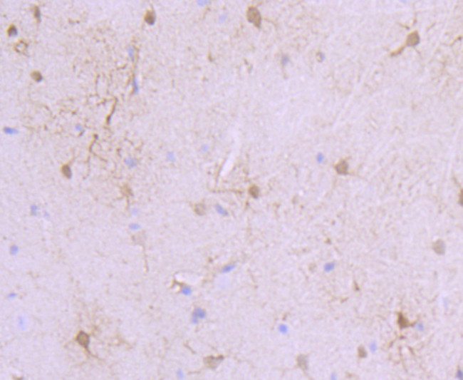 S100A6 Antibody in Immunohistochemistry (Paraffin) (IHC (P))