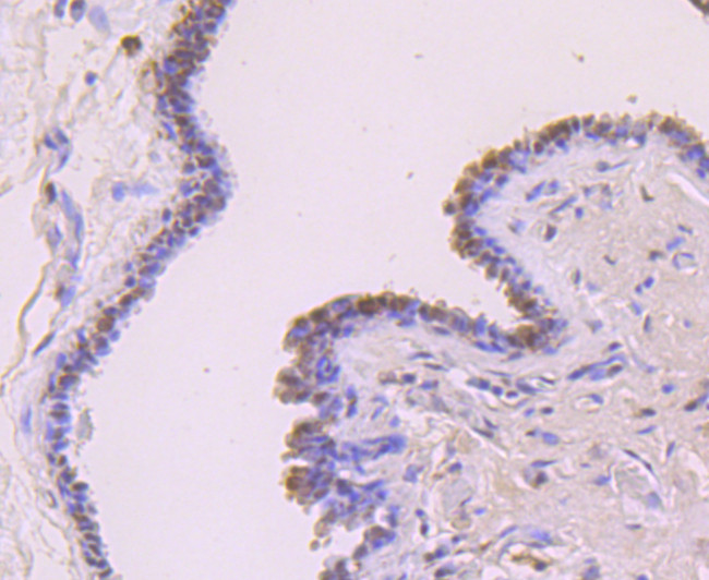 FOXP1 Antibody in Immunohistochemistry (Paraffin) (IHC (P))