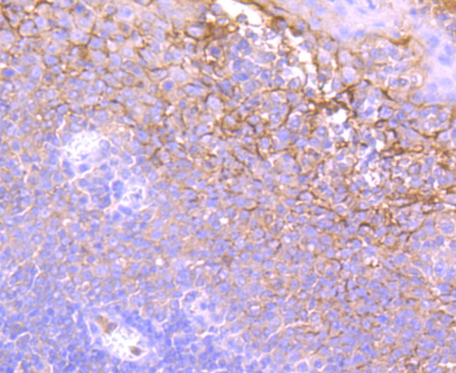 Neutrophil elastase Antibody in Immunohistochemistry (Paraffin) (IHC (P))