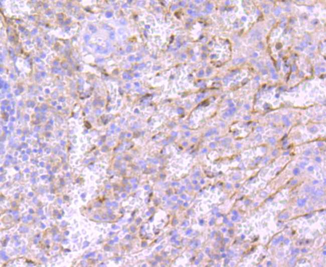 Neutrophil elastase Antibody in Immunohistochemistry (Paraffin) (IHC (P))
