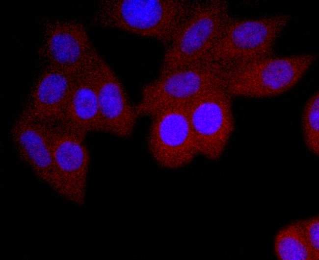 Human IgA Antibody in Immunocytochemistry (ICC/IF)