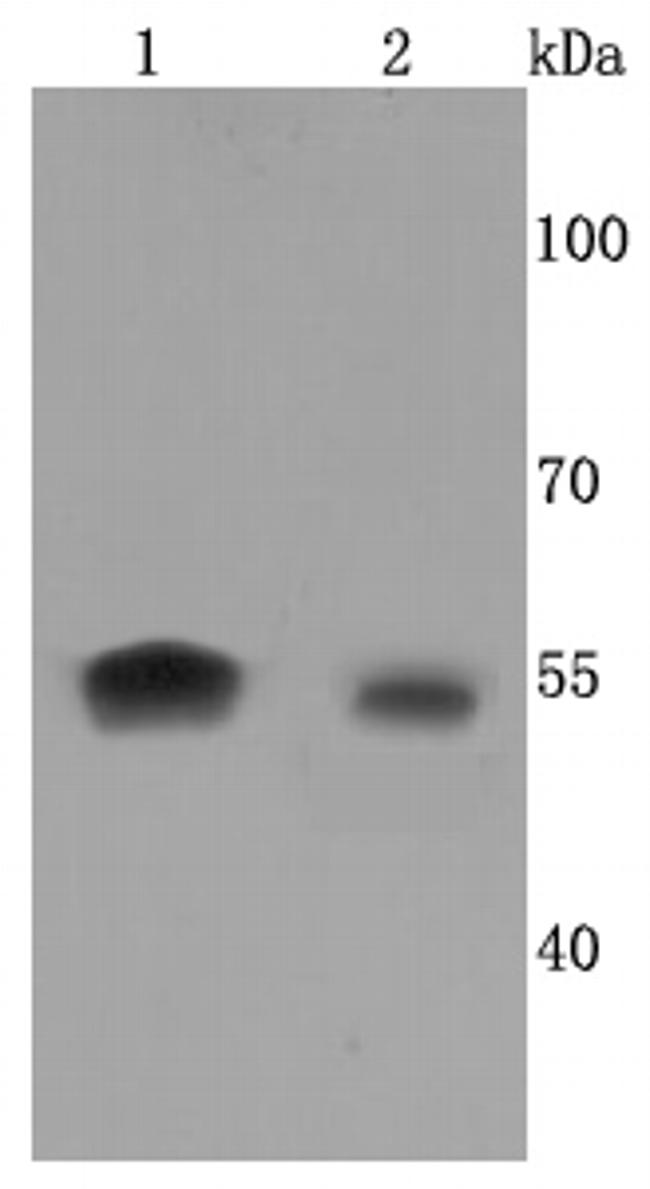 Aromatase Antibody in Western Blot (WB)