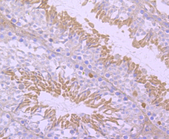 NUR77 Antibody in Immunohistochemistry (Paraffin) (IHC (P))