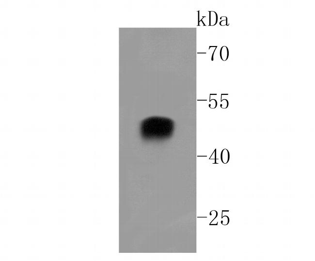 Alpha Sarcoglycan Antibody in Western Blot (WB)