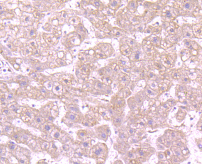 CD163 Antibody in Immunohistochemistry (Paraffin) (IHC (P))