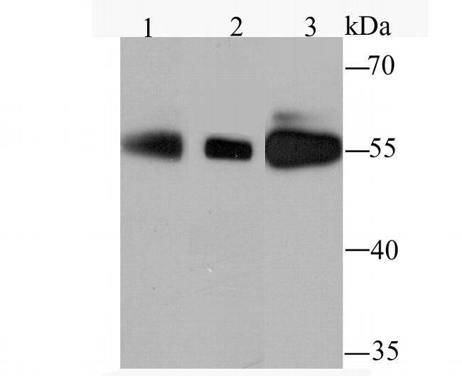 PFKFB3 Antibody in Western Blot (WB)