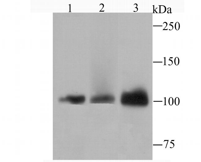 DNA ligase IV Antibody in Western Blot (WB)
