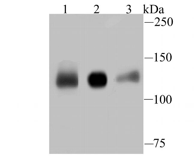 KIF11 Antibody in Western Blot (WB)