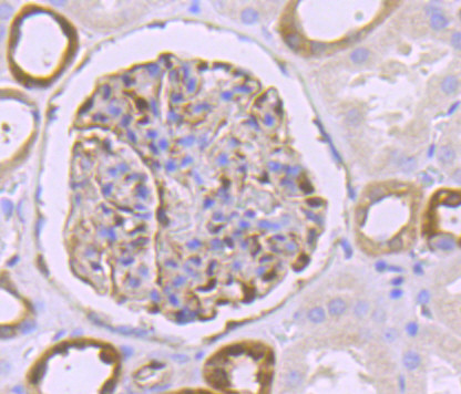 CD317 (BST2, PDCA-1) Antibody in Immunohistochemistry (Paraffin) (IHC (P))