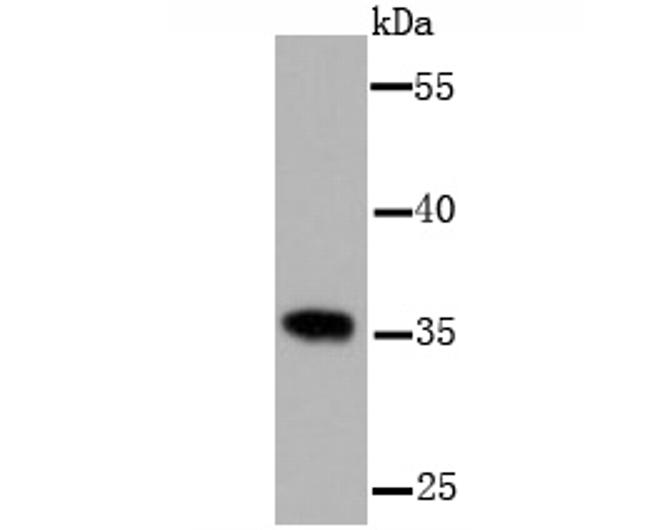 PP2A alpha/beta Antibody in Western Blot (WB)