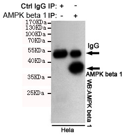 AMPK beta-1 Antibody in Immunoprecipitation (IP)