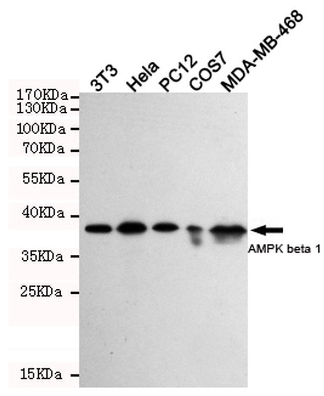 AMPK beta-1 Antibody in Western Blot (WB)