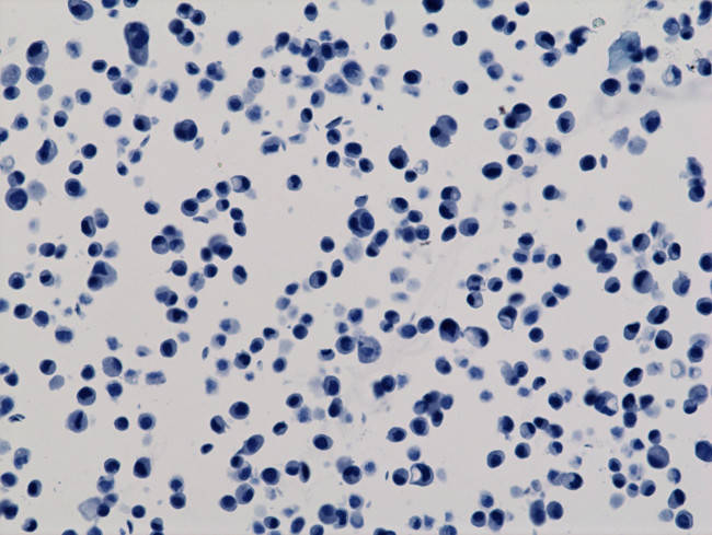 6x-His Tag Antibody in Immunocytochemistry (ICC/IF)