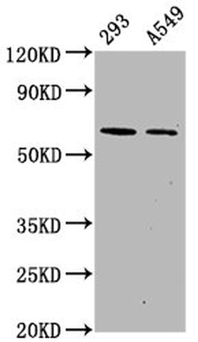 Phospho-AMPK alpha-2 (Ser491) Antibody in Western Blot (WB)
