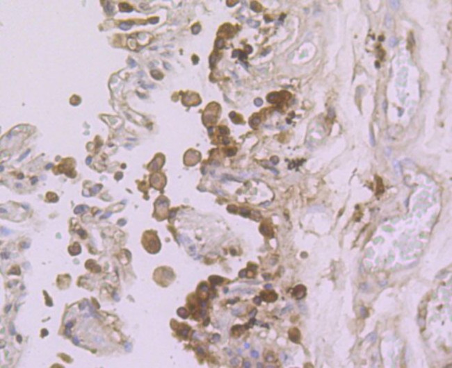 ADAR1 Antibody in Immunohistochemistry (Paraffin) (IHC (P))
