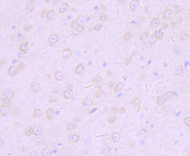 Furin Antibody in Immunohistochemistry (Paraffin) (IHC (P))