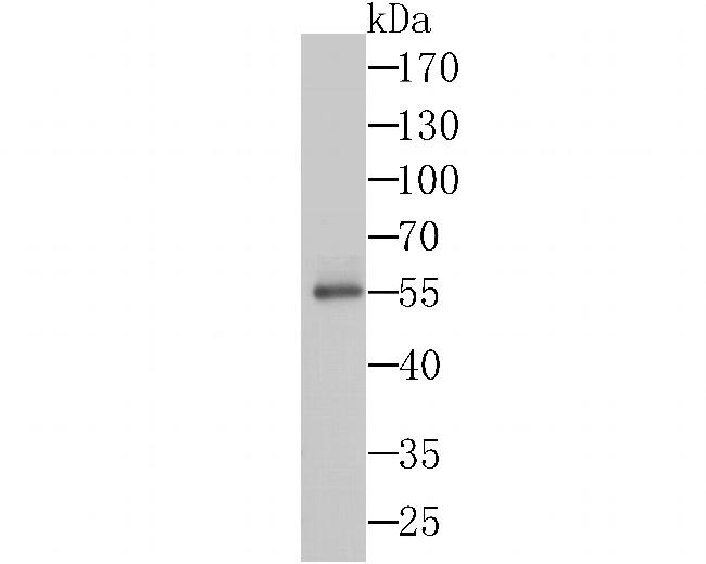 Syntrophin alpha-1 Antibody in Western Blot (WB)