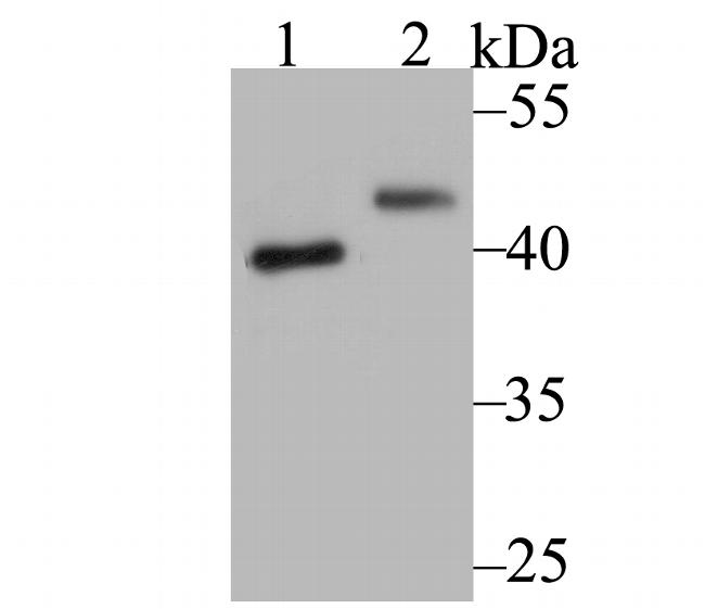SUV39H2 Antibody in Western Blot (WB)