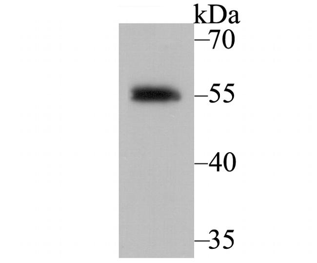RXRA Antibody in Western Blot (WB)