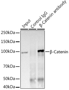 beta Catenin Antibody in Immunoprecipitation (IP)