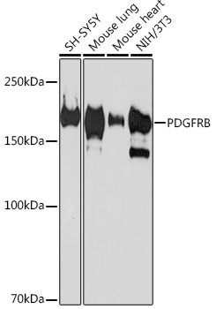 PDGFRB Antibody in Western Blot (WB)