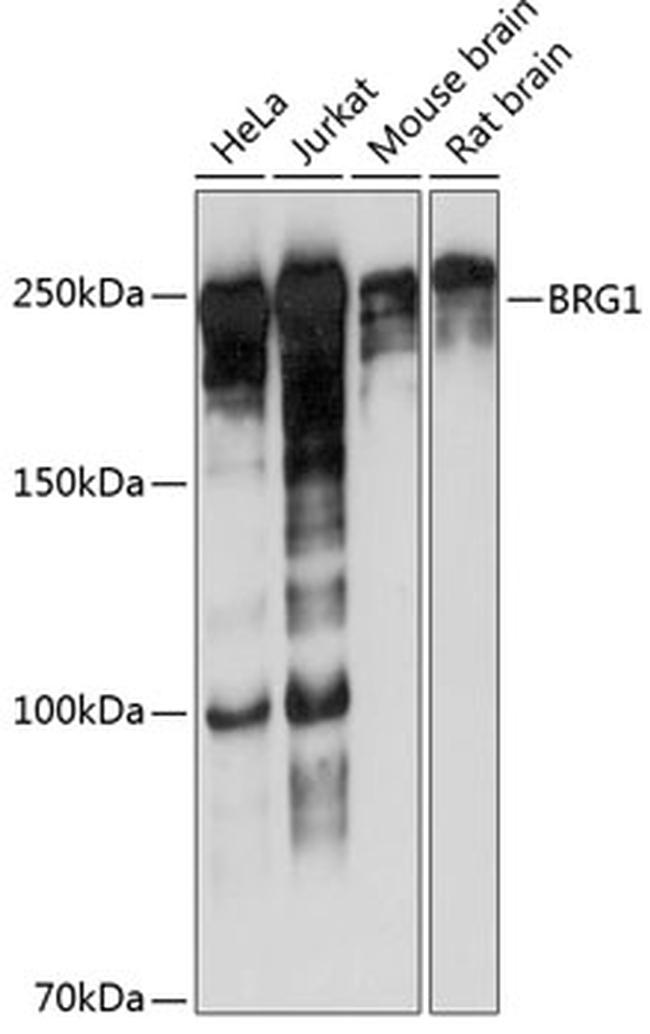BRG1 Antibody in Western Blot (WB)