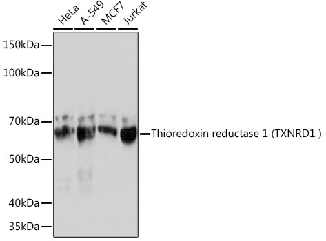 TrxR1 Antibody in Western Blot (WB)