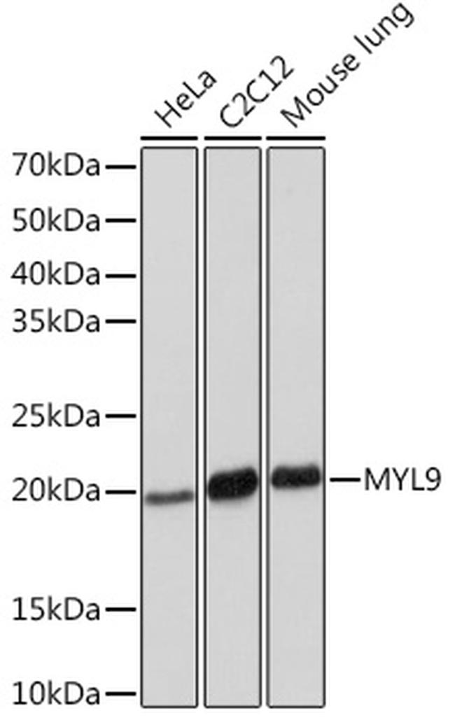 MYL9 Antibody in Western Blot (WB)