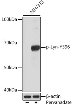 Phospho-Lyn (Tyr396) Antibody in Western Blot (WB)