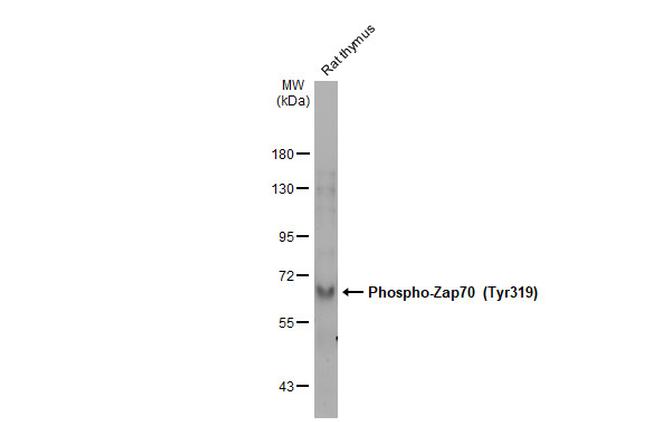 Phospho-Zap-70 (Tyr319, Tyr352) Antibody in Western Blot (WB)