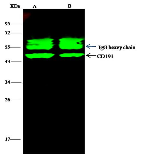 CCR1 Antibody in Immunoprecipitation (IP)