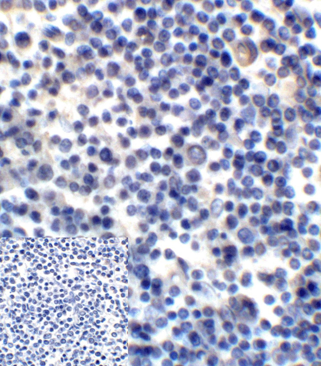 CD276 (B7-H3) Antibody in Immunohistochemistry (IHC)