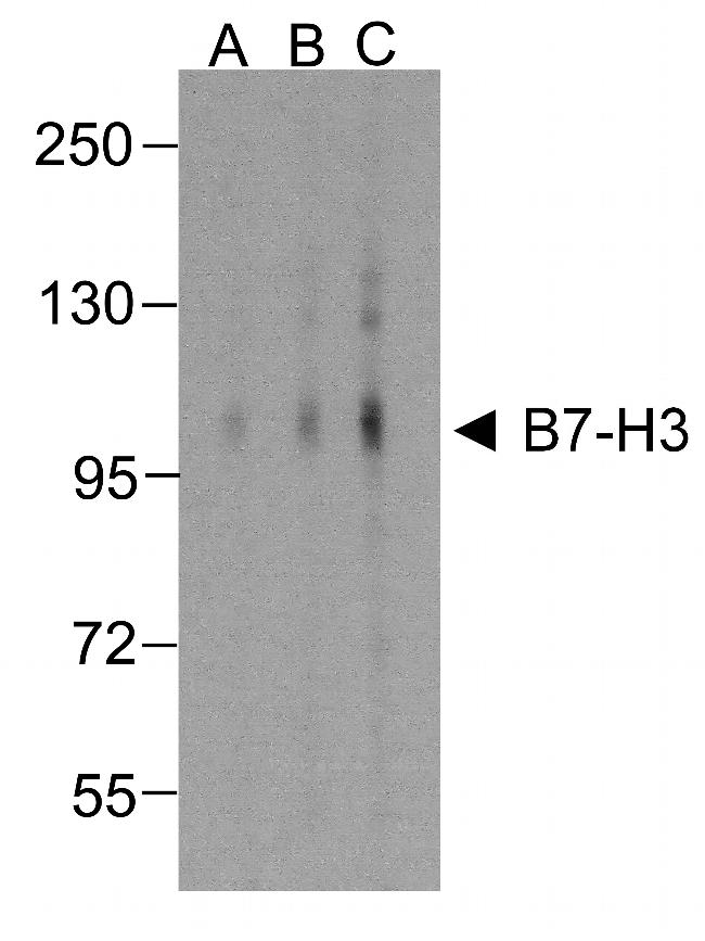 CD276 (B7-H3) Antibody in Western Blot (WB)
