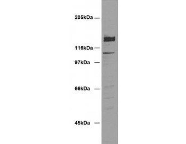 Desmoglein 2 Antibody in Western Blot (WB)