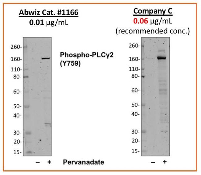 Phospho-PLCg2 (Tyr759) Antibody in Western Blot (WB)