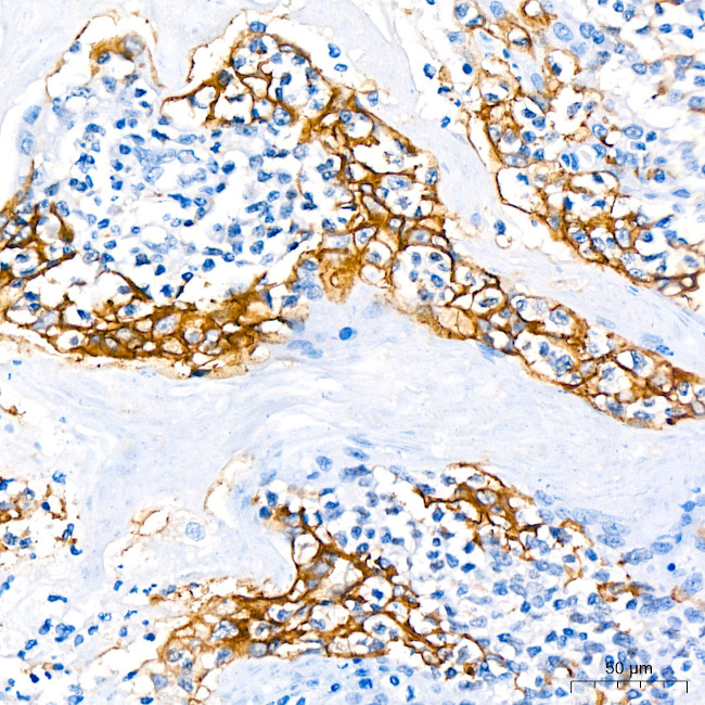 PD-L1 (CD274) Antibody in Immunohistochemistry (Paraffin) (IHC (P))