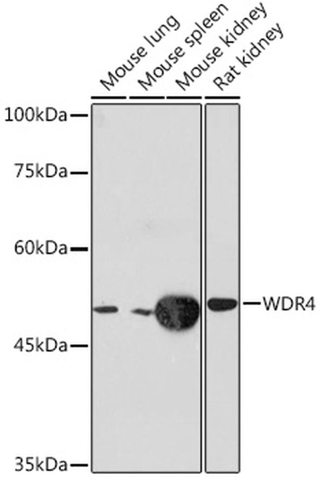 WDR4 Antibody in Western Blot (WB)
